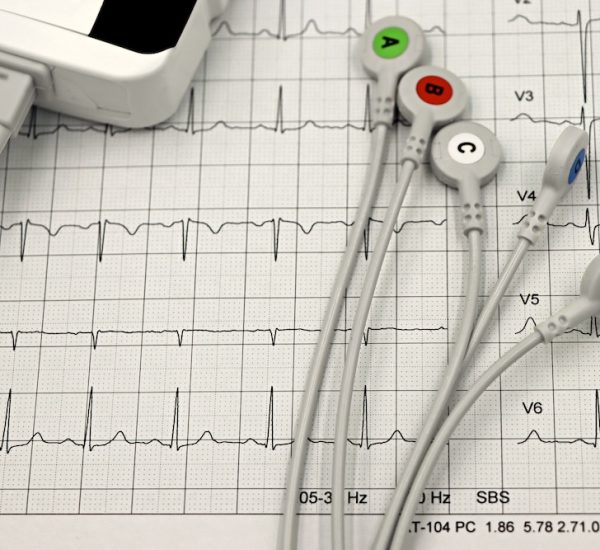 arrhythmia detection