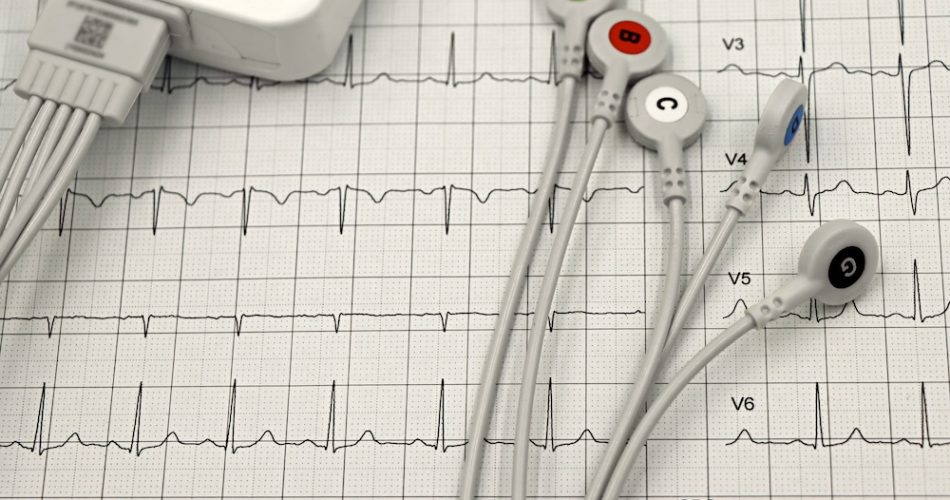 arrhythmia detection
